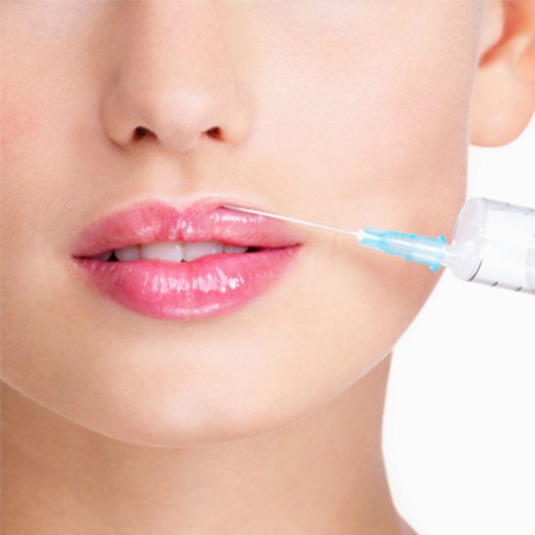preenchimento labial