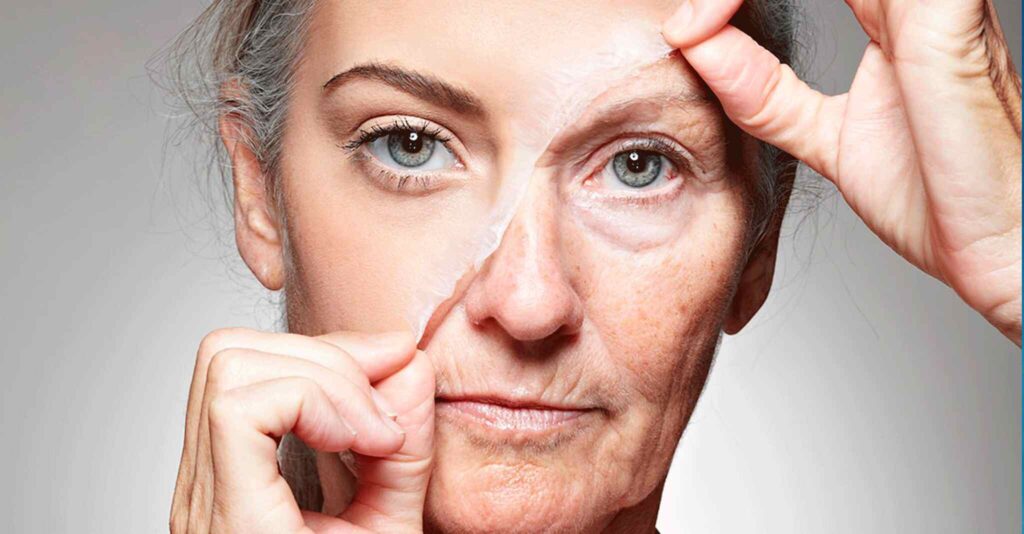 Mulher com pele descamando após peeling.