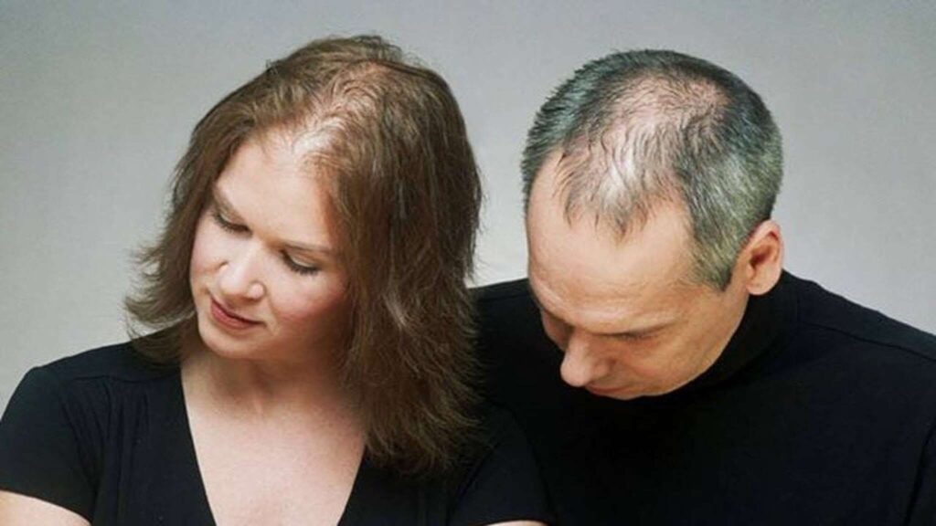 Homem e mulher com calvície