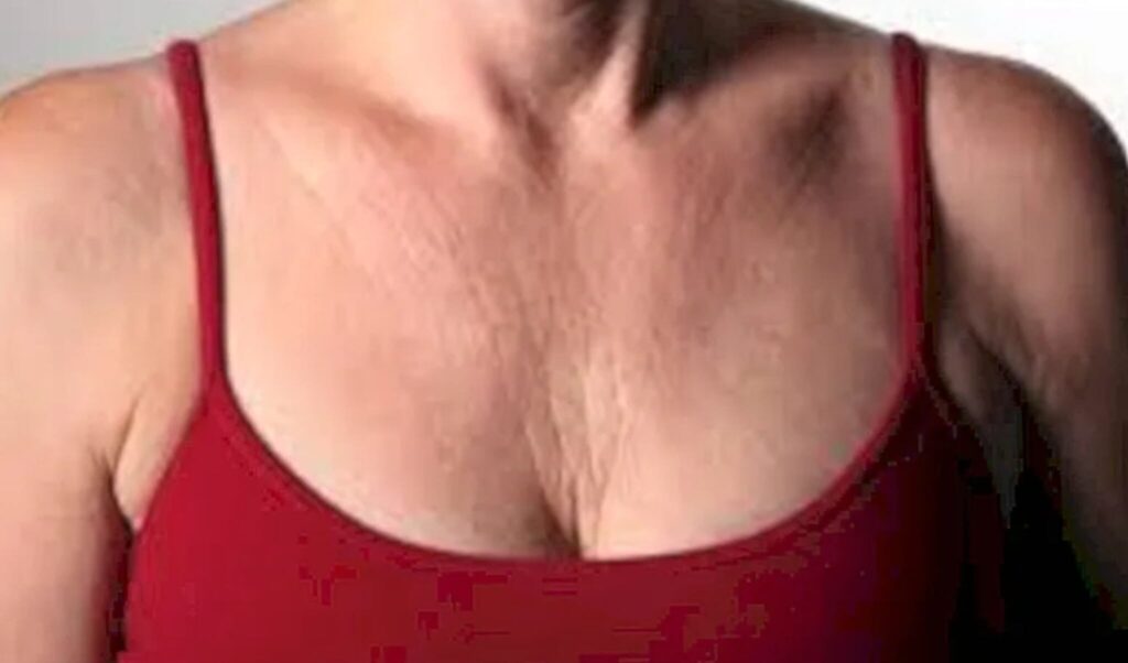 colo envelhecido