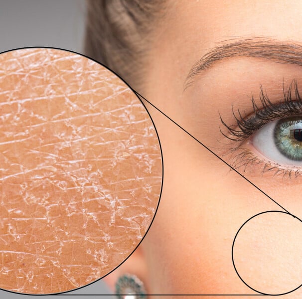 Uma pele bem hidratada é a base para uma aparência saudável, jovem e radiante.