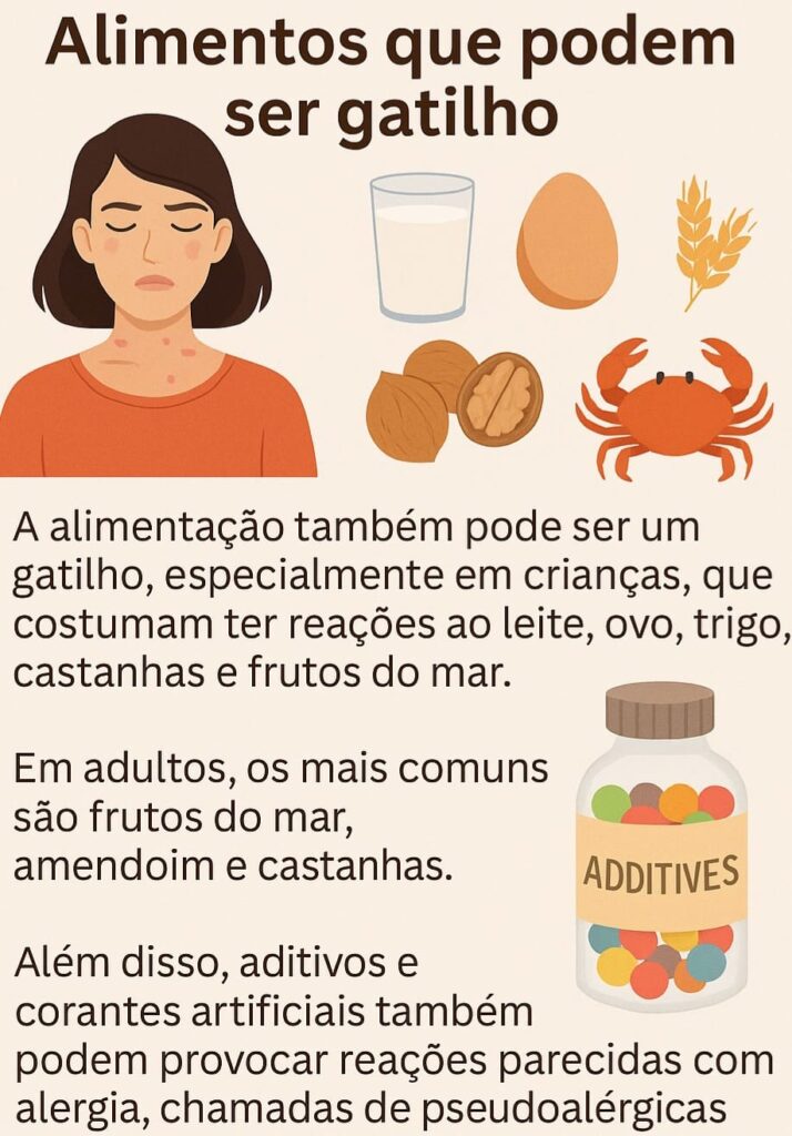 Na urticária aguda conhecer os possíveis gatilhos pode evitar muitas crises.- lista de alimentos